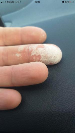 [VIDEO] Żrącą substancję do czyszczenia rur policjant w Nowych Skalmierzycach i prokurator w Ostrowie Wlkp. uznali za lek! Niekompetencja czy wspieranie przestępstw, również przy budowie wiatraków?