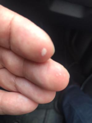 [VIDEO] Żrącą substancję do czyszczenia rur policjant w Nowych Skalmierzycach i prokurator w Ostrowie Wlkp. uznali za lek! Niekompetencja czy wspieranie przestępstw, również przy budowie wiatraków?